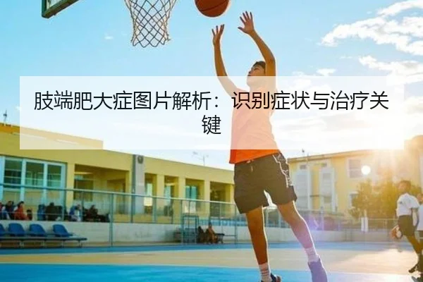 肢端肥大症图片解析：识别症状与治疗关键